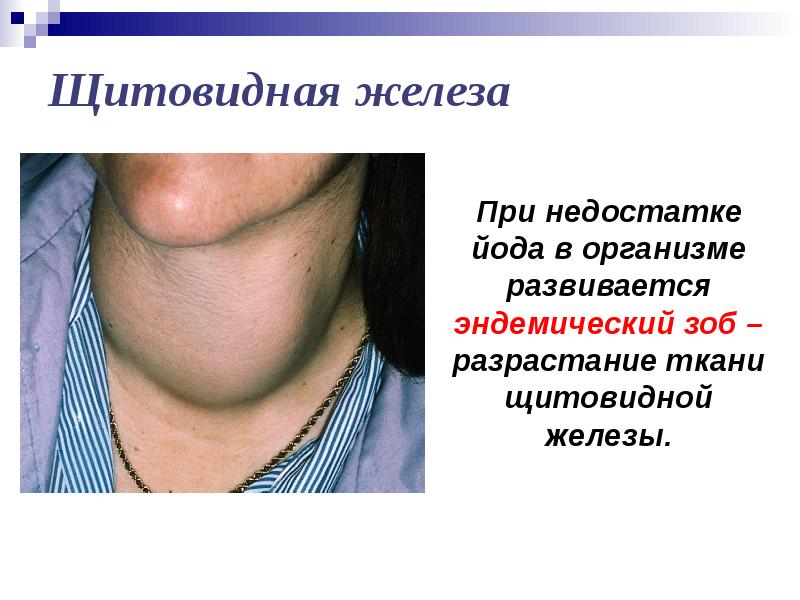 Щитовидной Железы Что Это Такое Фото