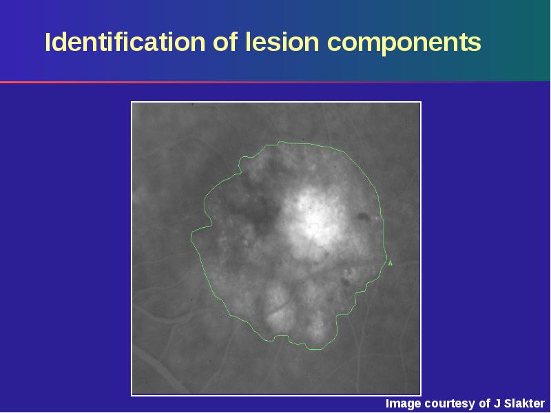 Identification of lesion components Identification of lesion components