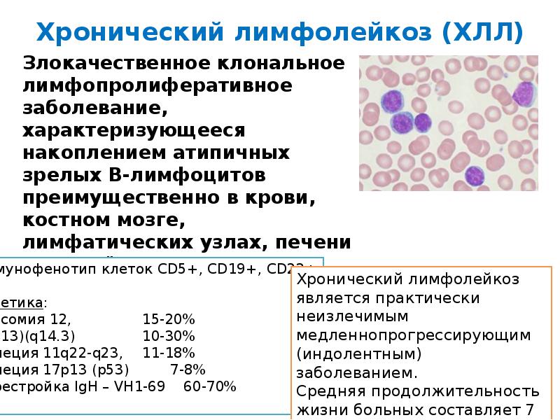 Лимфолейкоз анализ крови