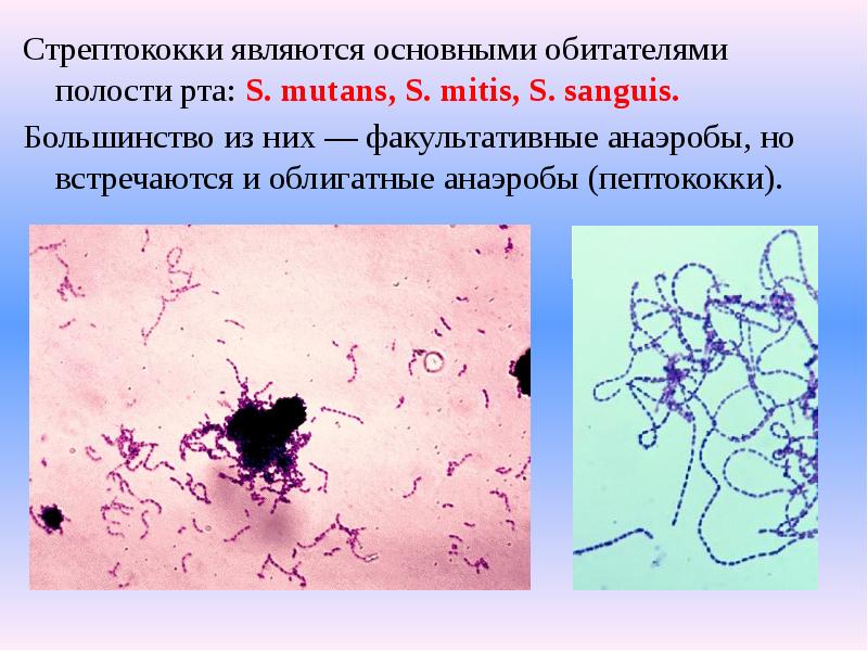 Streptococcus mitis