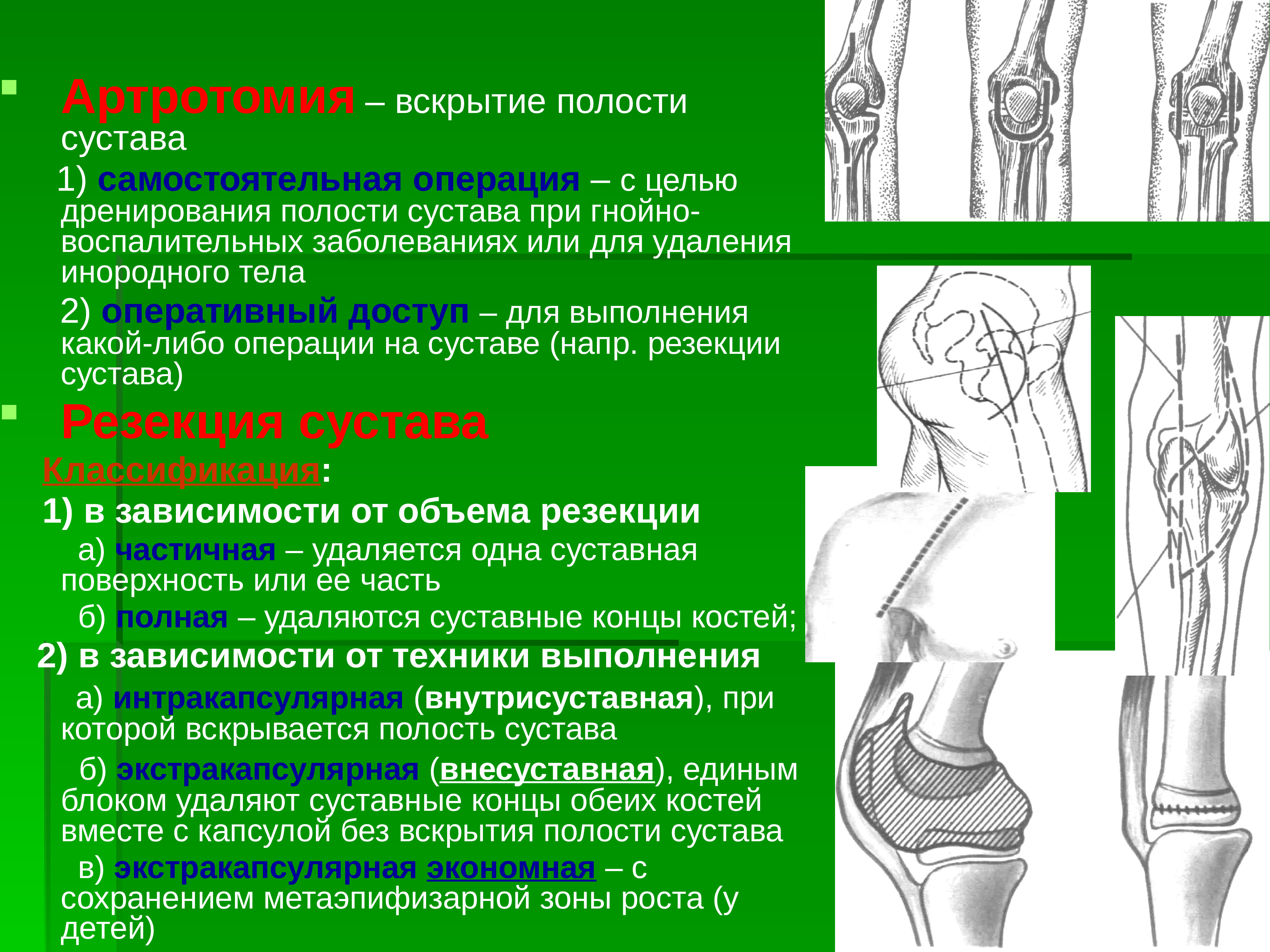 Артротомия плечевого сустава. Артротомия тазобедренного сустава. Артротомия тазобедренного сустава сустава. Артротомия коленного сустава топографическая анатомия. Доступы для вскрытия коленного сустава.