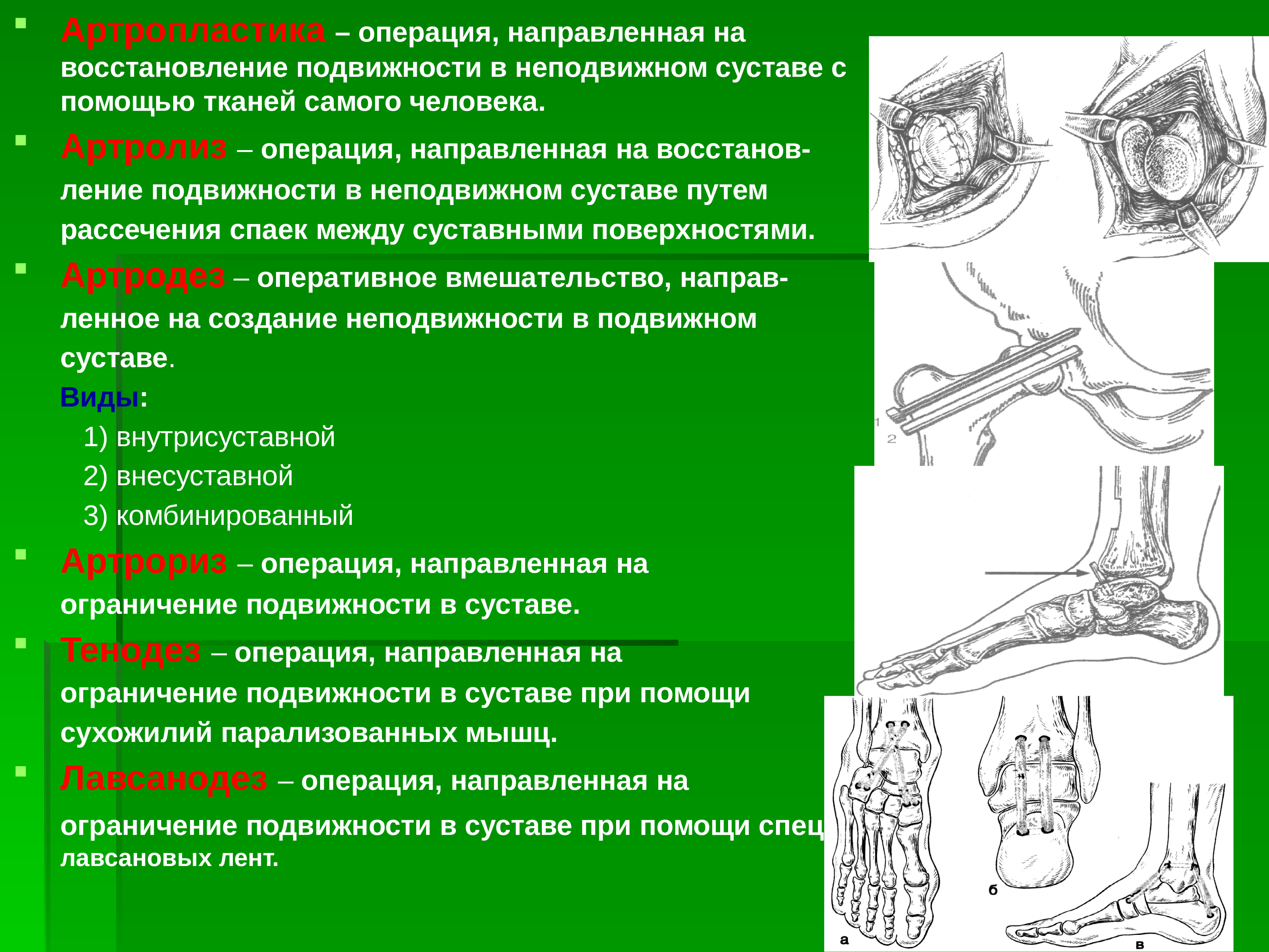 Оперативная хирургия нижней конечности презентация