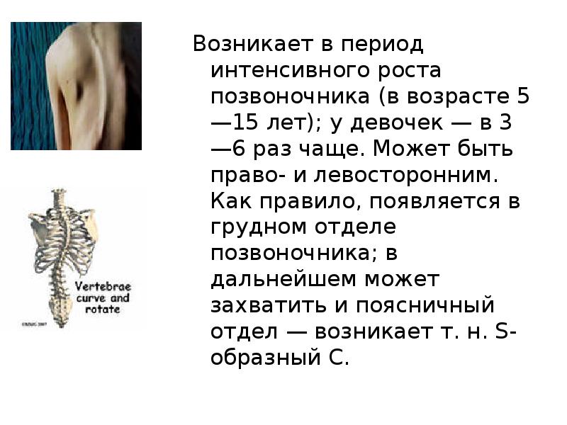 Периоды интенсивного роста. Период роста позвоночника. Рост позвоночника. Усиление темпов роста позвоночника отмечается в каком возрасте.