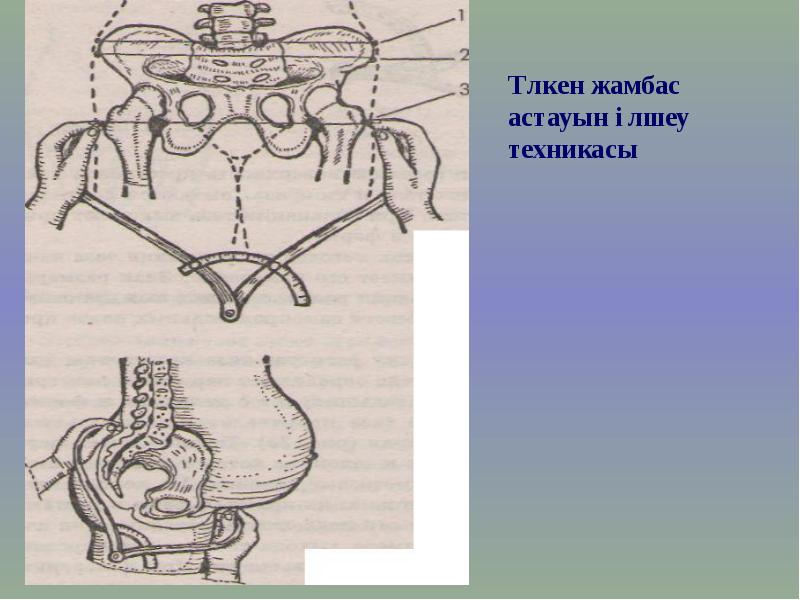 Жамбас. Жамбас