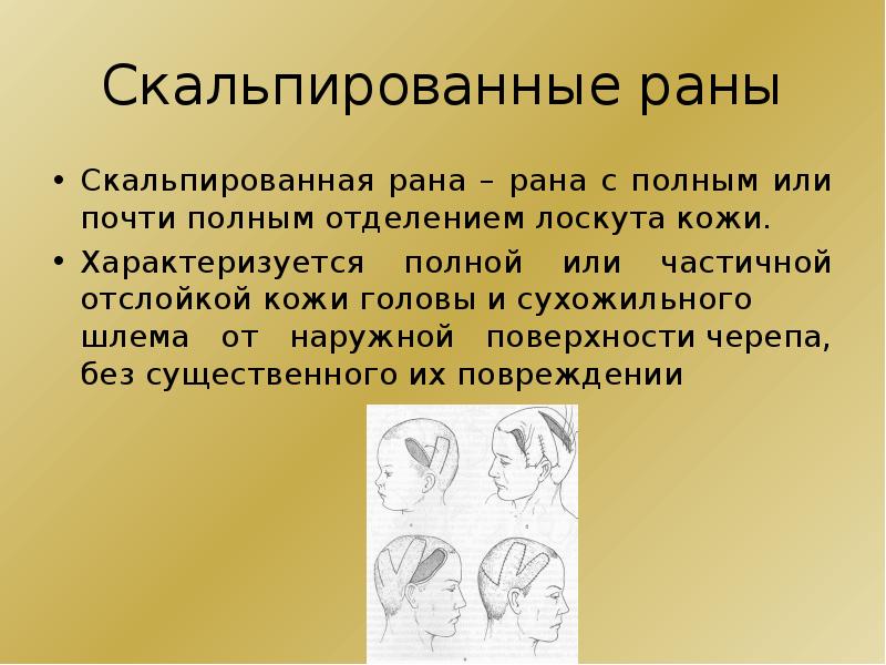 Скальпированная рана мкб 10. Скальпированная рана мкб 10