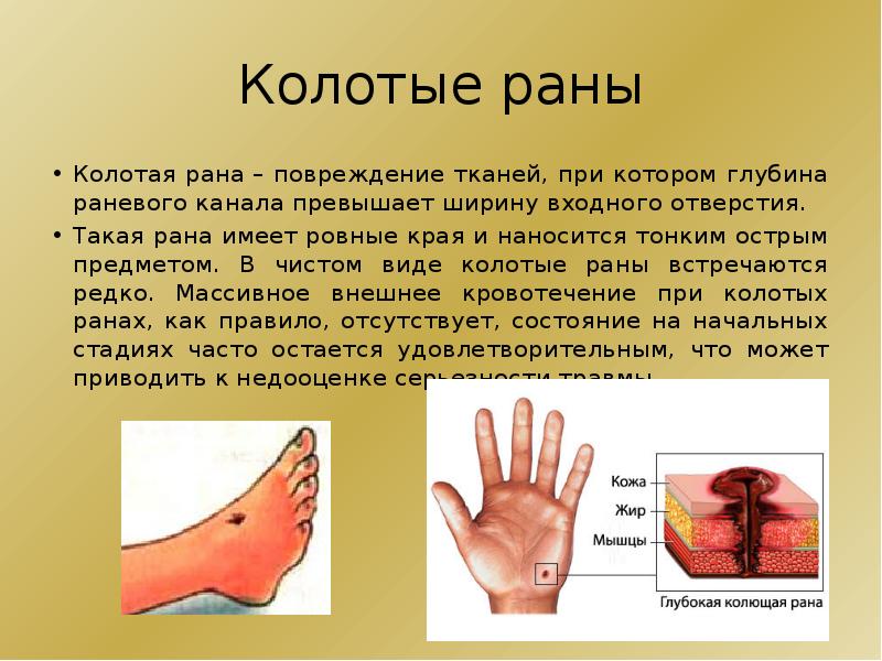 Колотая рана стопы карта вызова смп