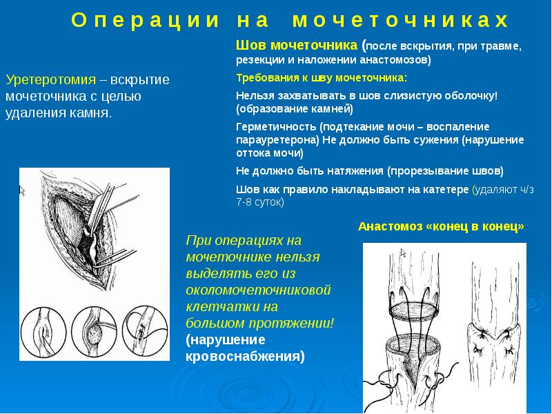 Презентация топография почек