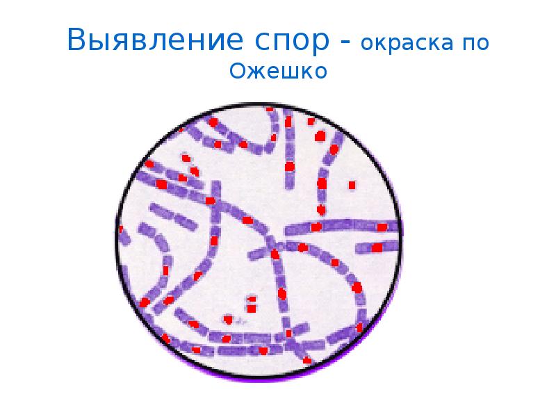 Спорообразование у бактерий методы обнаружения спор. Споры микробиология. Строение споры бактерий микробиология. Споры микробиология. Расположение спор микробиология.
