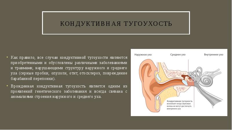 Кондуктивная тугоухость. Смешанная тугоухость. Кондуктивная и невральная глухота. Отосклероз презентация.