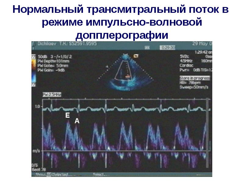 Учебный план эхокардиография