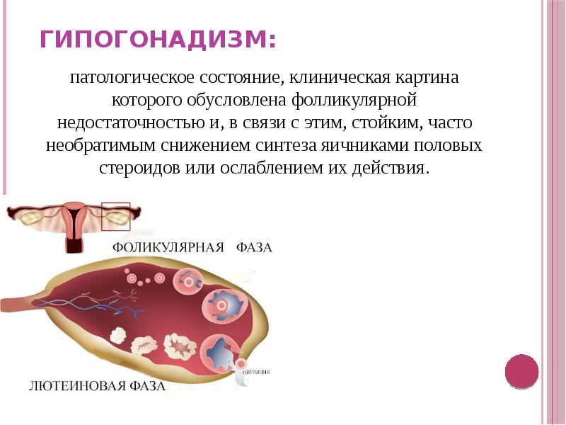 Клиническая картина бесплодия