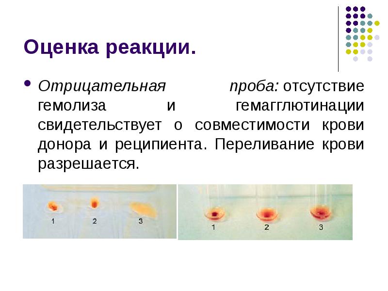 Определение степени липемии иктеричности и гемолиза образца