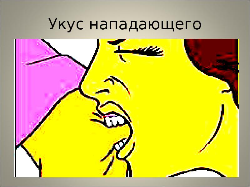 Укус нападающего Укус нападающего