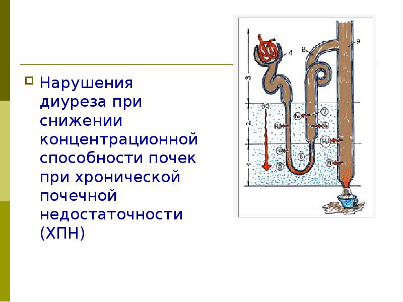 Средний диурез. Снижение диуреза. Патологии диуреза. Диурез это в медицине. Диурез картинки.