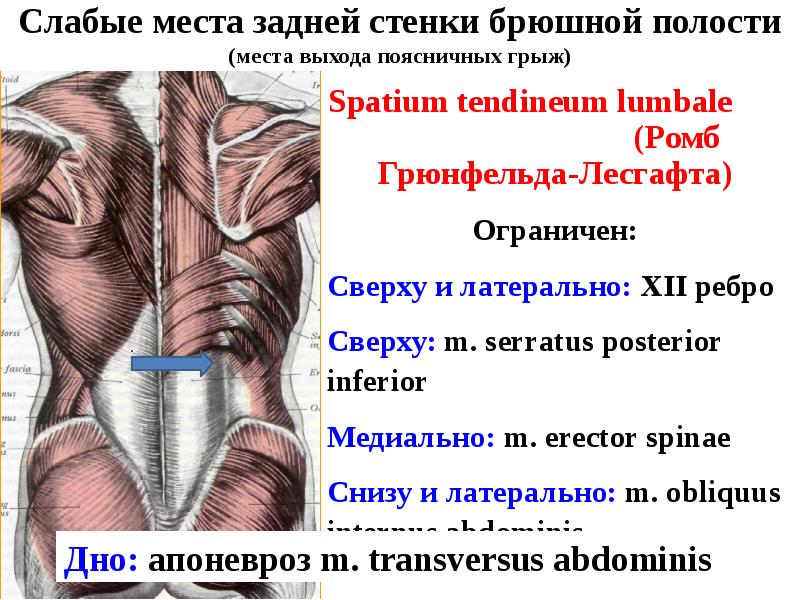 Топография брюшной стенки презентация