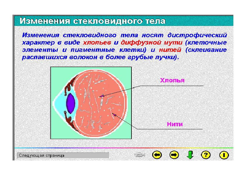 Презентация аномалии рефракции