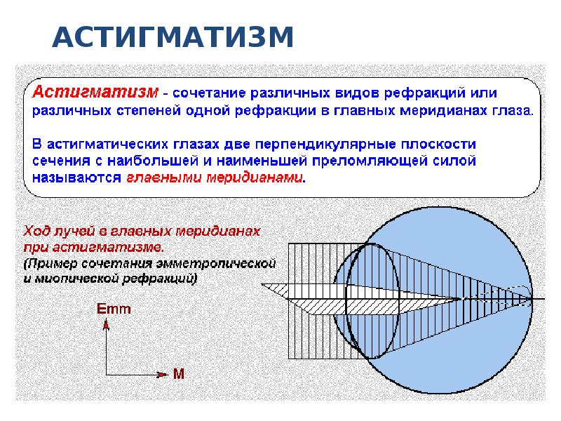 Рефракция презентация қазақша