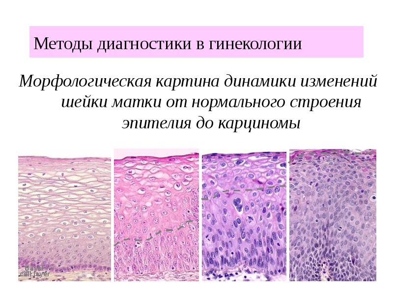 Что значит морфологическая картина