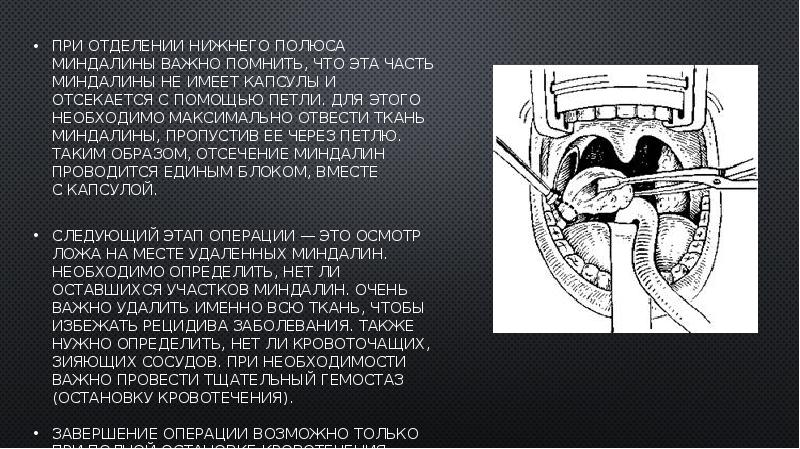 Синдром маршала презентация