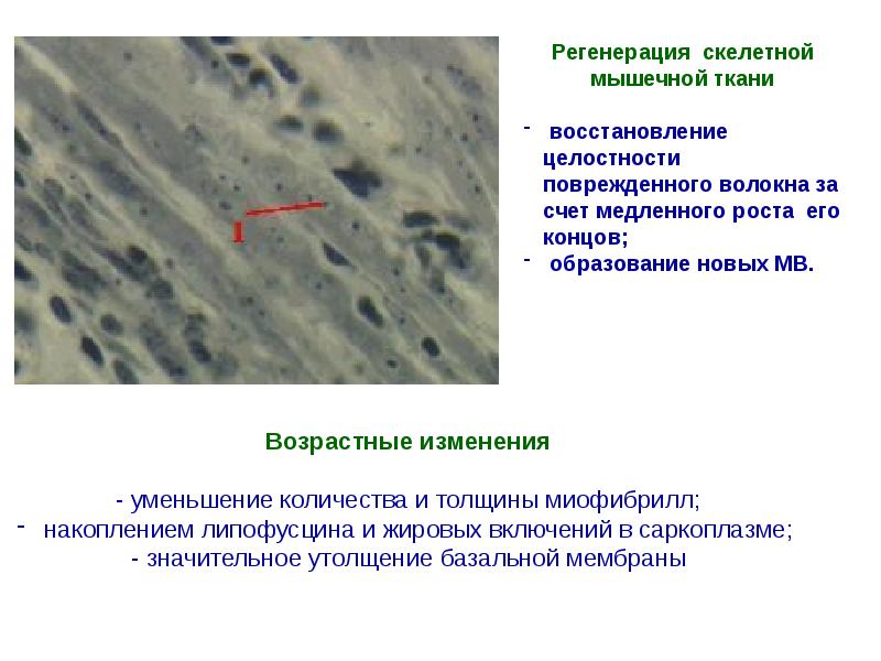 Регенерация тканей. Регенерация мышечной ткани схема. Регенерация поперечно полосатой скелетной мышечной ткани. Репаративная регенерация мышечной ткани. Репаративная регенерация скелетной мышечной ткани.