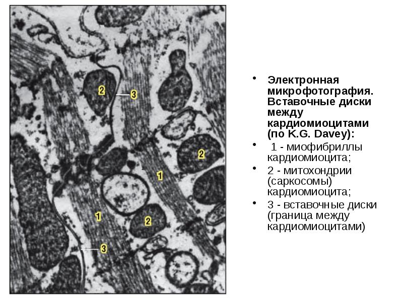 Схема вставочного диска между кардиомиоцитами