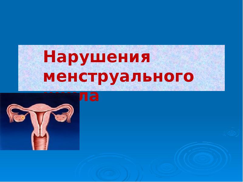 Нарушения менструационного цикла гинекология презентация