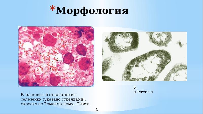 Возбудитель туляремии микробиология презентация