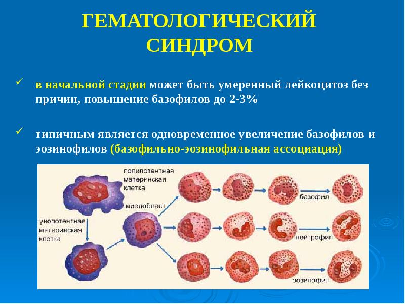 Эозинофильный лейкоцитоз. Гематопоэический синдом. Гематологический синдром. Гематологические болезни классификация. Гематологическое заболевание крови.