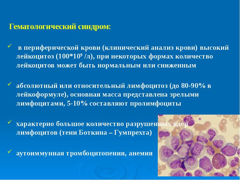 Лейкозы картинки для презентации