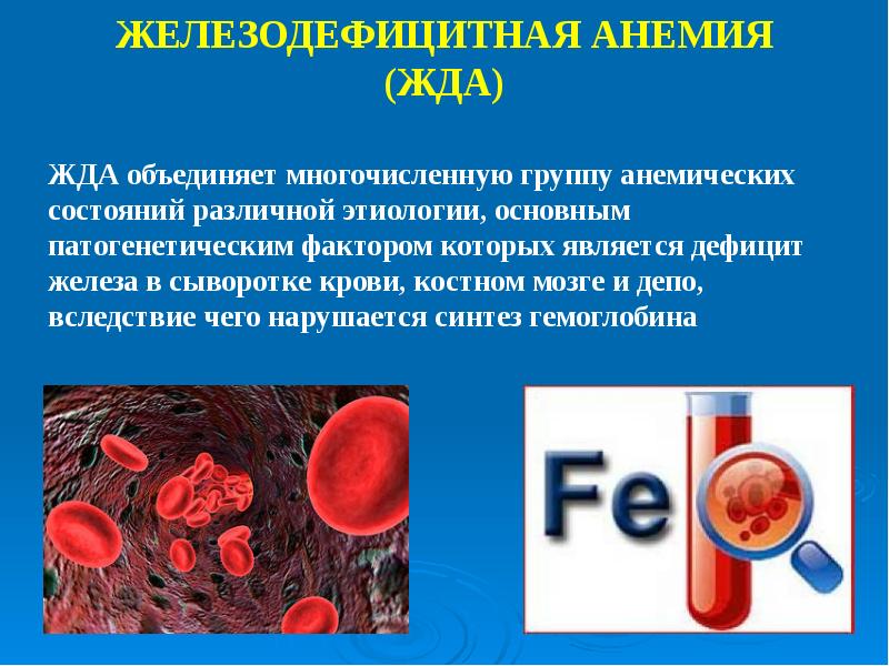 Анемия сопровождается. Заболевание крови анемия. Железодефицитная анемия (жда). Понятие о железодефицитной анемии.