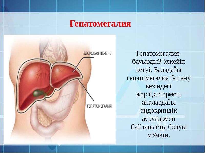 Гепатомегалия что это как лечат. Гепатомегалия.