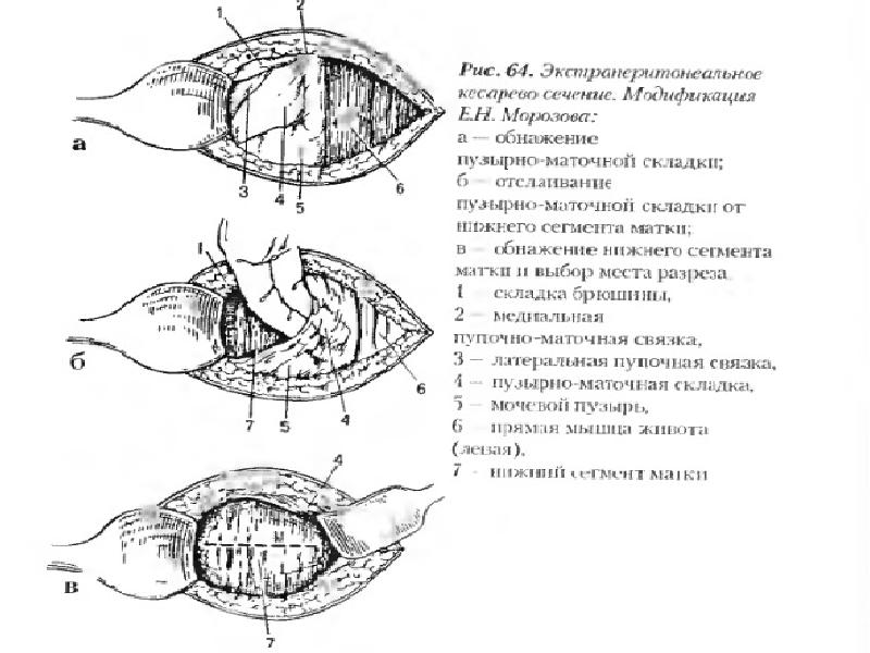 Кесарево сечение коровы презентация