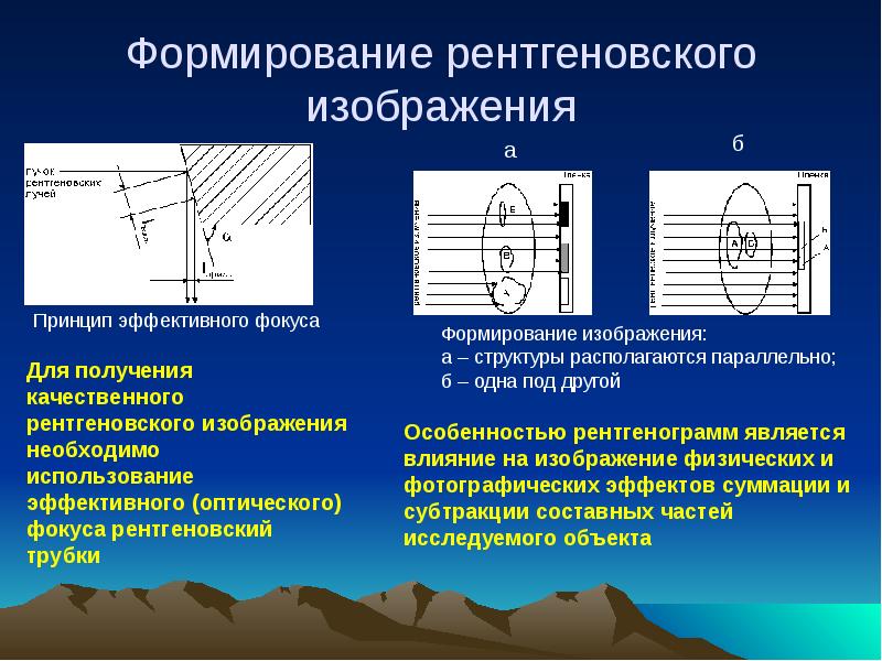 Рентгеновское изображение. Физические аспекты получения рентгеновского изображения. Формирование рентгеновского изображения. Формирование рентгеноскопического изображения.. Формирование рентген изображения.