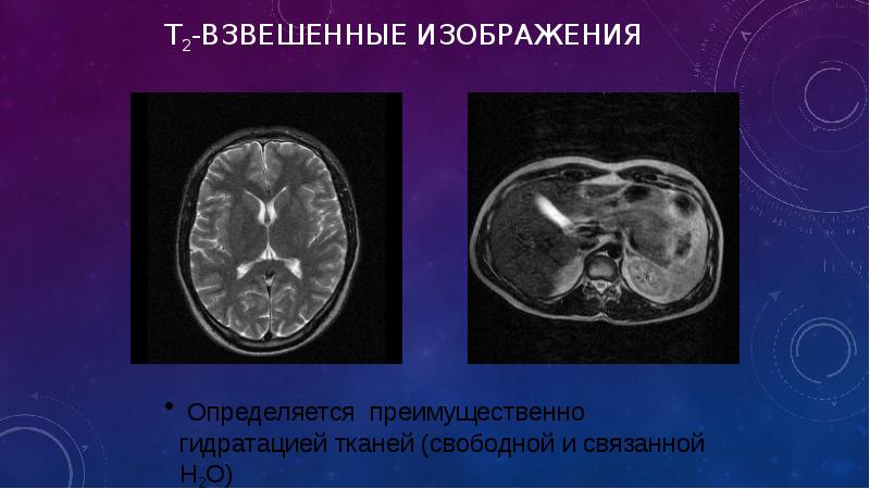 Т1 и т2 взвешенные изображения