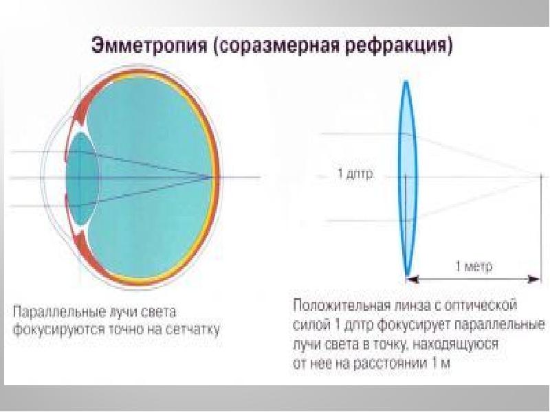 Изучите физиологию зрения рассмотрите схемы рефракции при нормальном зрении