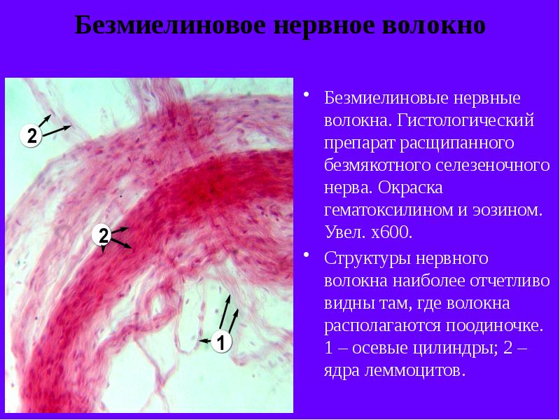 Безмиелиновые нервные волокна рисунок