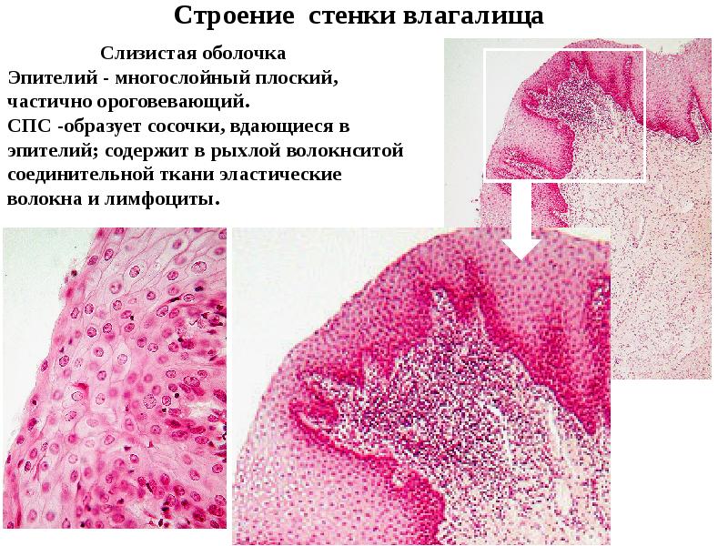 Строение Вагины Девственницы Строение Вагины Девственницы