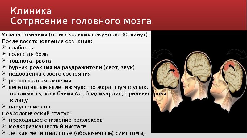 Сотрясение память. Сотрясение мозга симптомы. Проявления сотрясения головного мозга. Признаки сотрясения головы. Сотрясение головы и головного мозга.