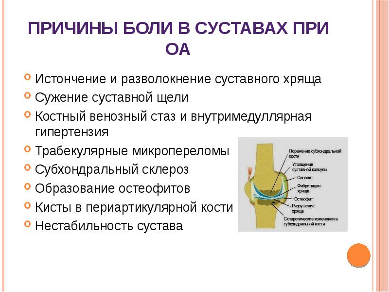 Диагностика заболеваний суставов презентация