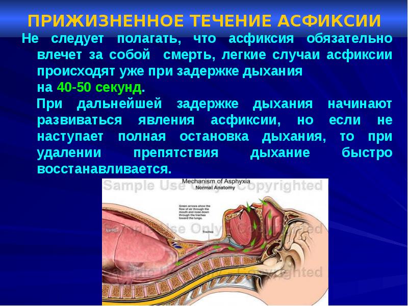 Судебная медицина асфиксия презентация