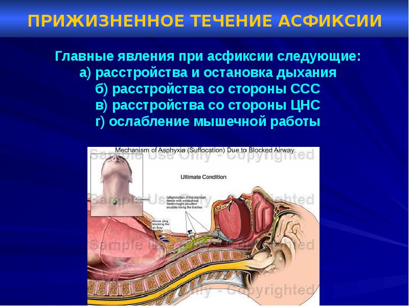 Судебная медицина асфиксия презентация