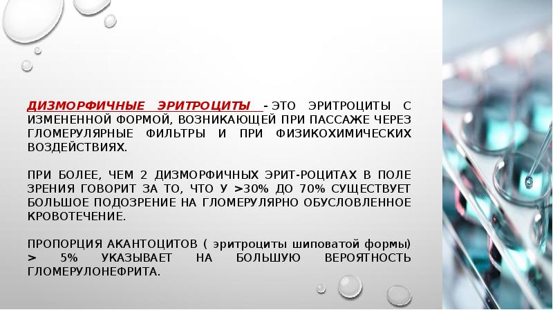 Код мкб эритроцитурия. Код мкб эритроцитурия