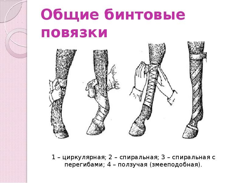 Общие бинтовые повязки Общие бинтовые повязки