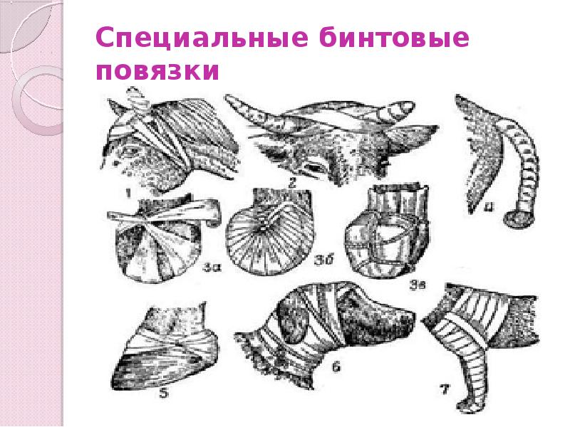 Специальные бинтовые повязки Специальные бинтовые повязки