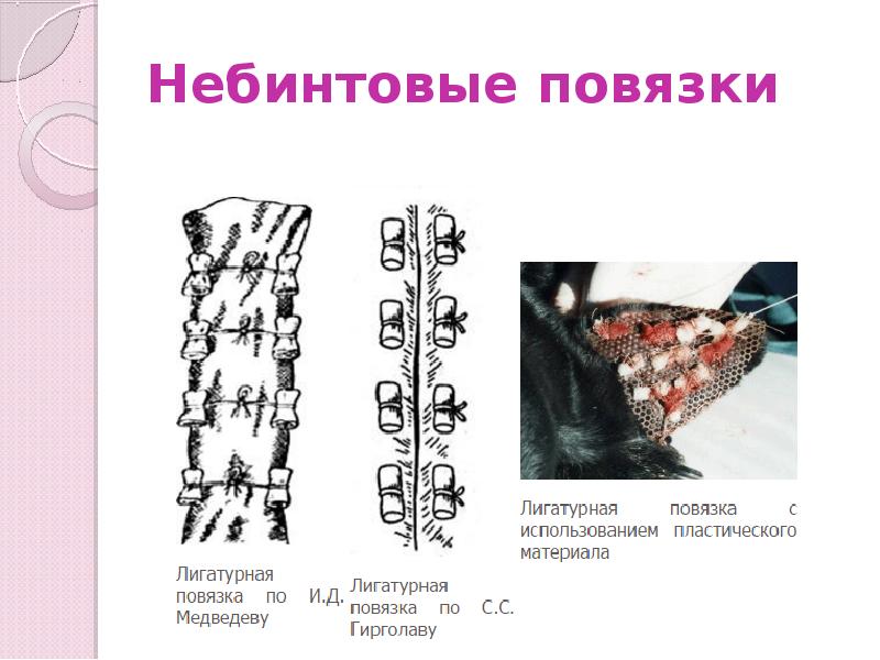 Небинтовые повязки Небинтовые повязки
