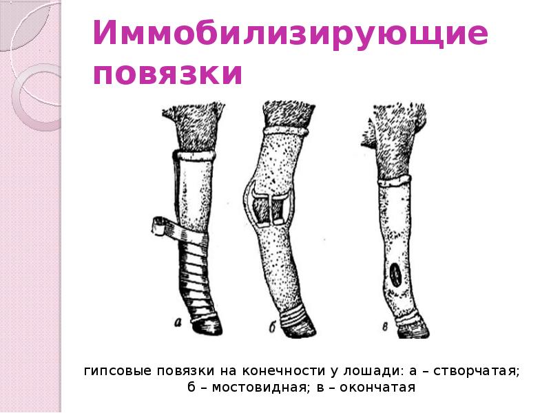 Иммобилизирующие повязки Иммобилизирующие повязки