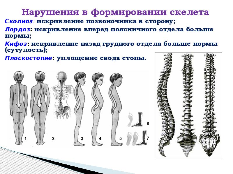 Нарушения ода презентация