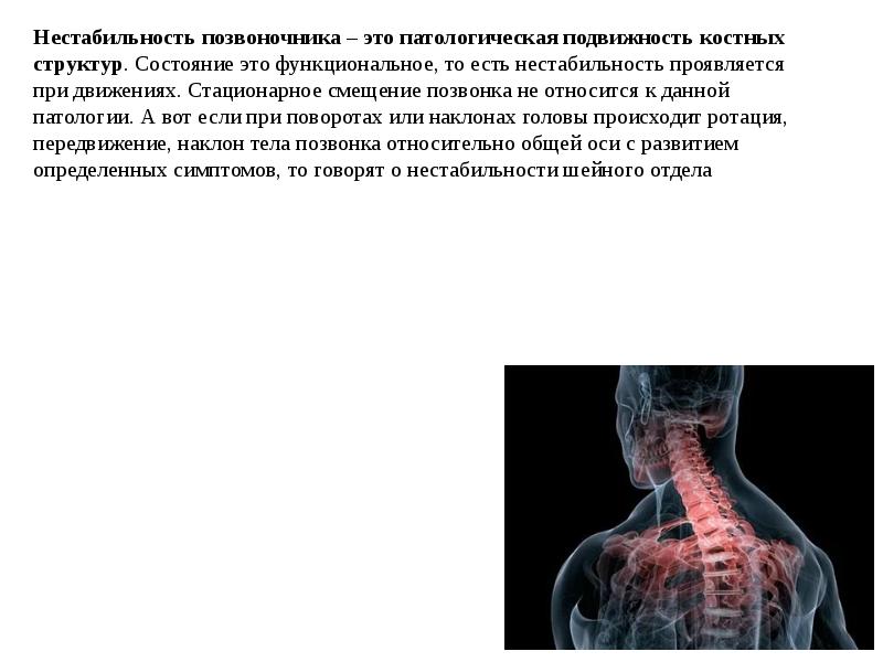 Расщепление позвоночника презентация