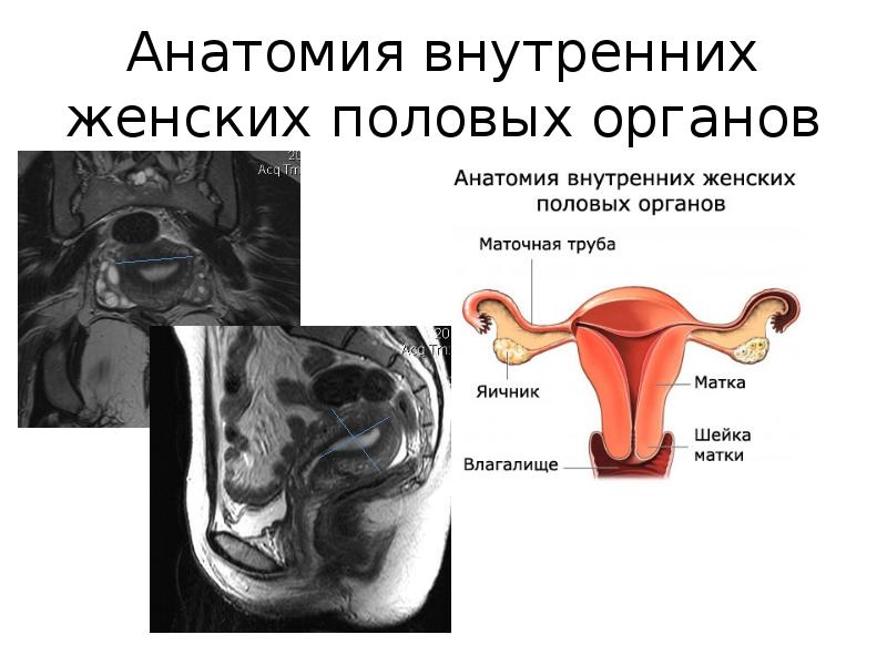 Анатомия матки презентация