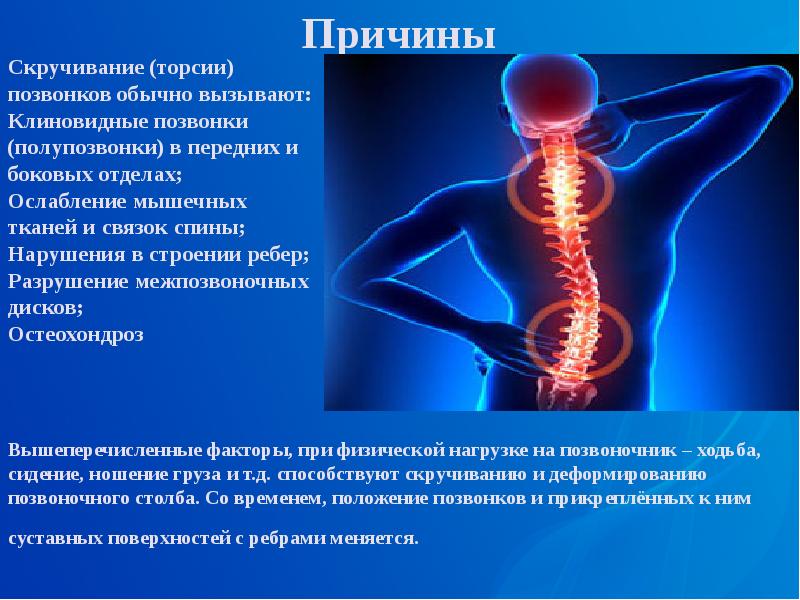 Заболевание опорно двигательного аппарата презентация